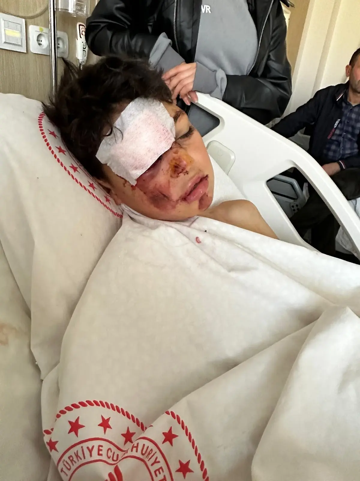 Aksaray’da Bisikletliye Otomobil Çarptı, Sürücü Kaçtı